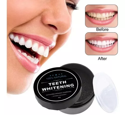 TeethWhitening™ | Blanqueador DENTAL - ¡LLEVA 2 PAGA 1!